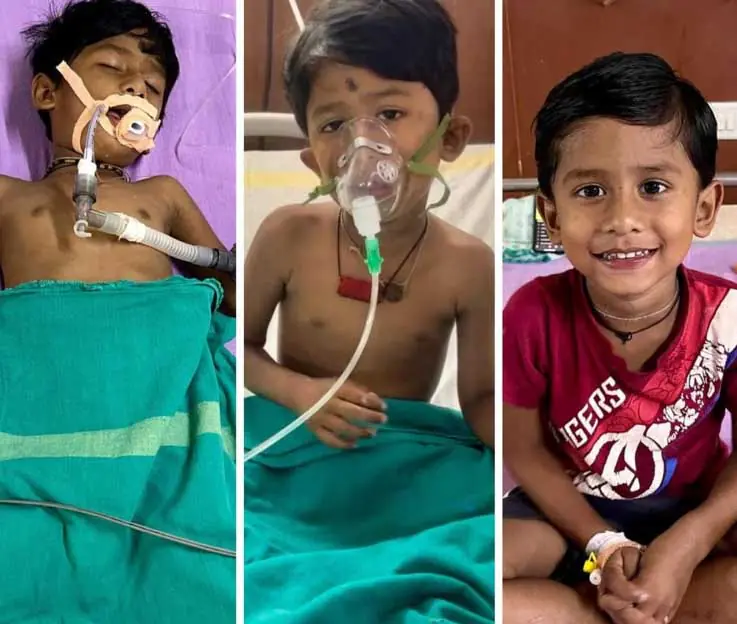 एक हफ्ते तक विशेषज्ञ चिकित्सकों की निगरानी में चला गहन इलाज